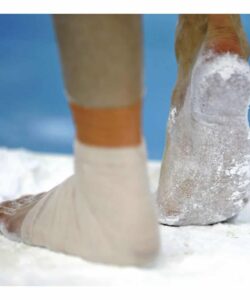 1389161-Magnesia-Holder-for-Feet-SPIETH